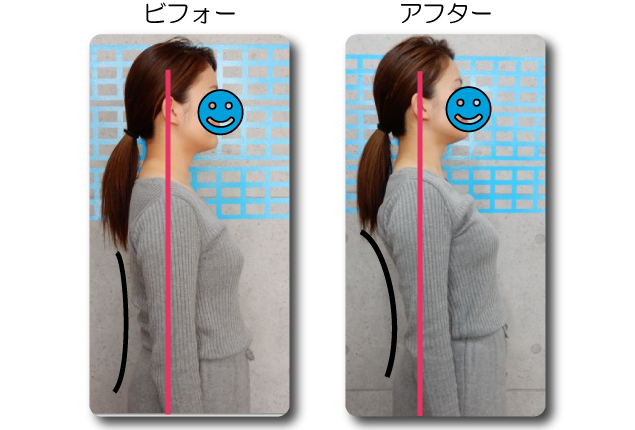 痛くない猫背矯正 西新福ふく整骨院